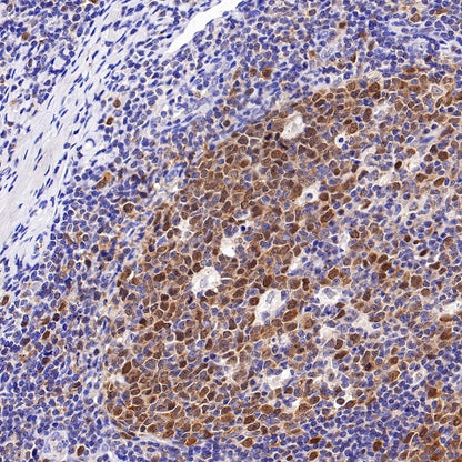 CDK2 Recombinant Rabbit mAb (S-1308-13)