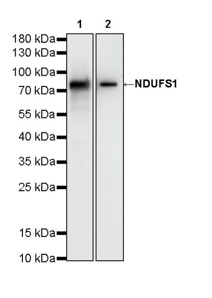 NDUFS1 Mouse mAb