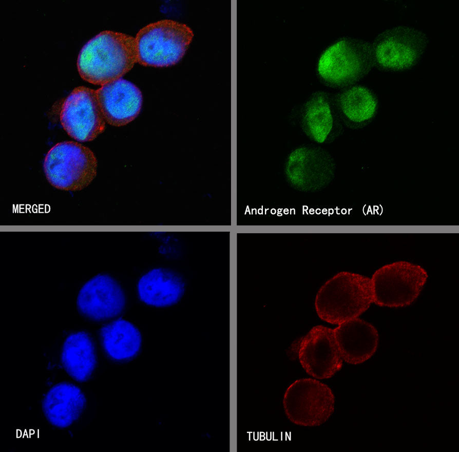 Androgen Receptor Recombinant Rabbit mAb (SDT-R167)