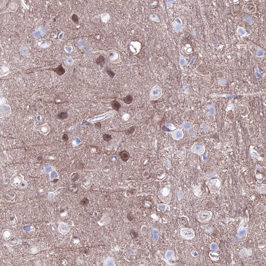 S-RMab® PTEN Recombinant Rabbit mAb (SDT-R069)