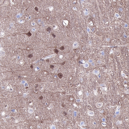 S-RMab® PTEN Recombinant Rabbit mAb (SDT-R069)