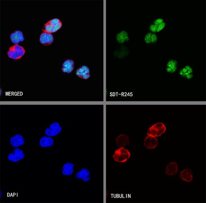 Terminal Deoxynucleotidyl Transferase (TdT) Recombinant Rabbit mAb (S-R245)