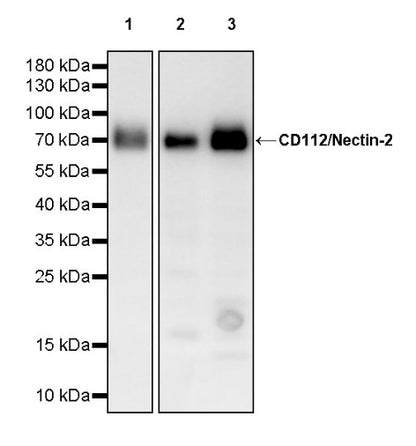 CD112/Nectin-2 Recombinant Rabbit mAb (S-2404-66)