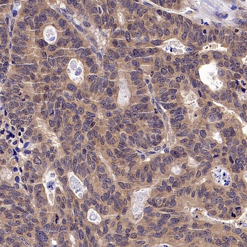 CK1α Recombinant Rabbit mAb ,PBS Only(SDT-2884-60)