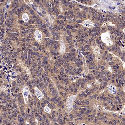 CK1α Recombinant Rabbit mAb ,PBS Only(SDT-2884-60)