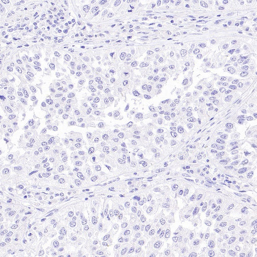 NKX3.1 Recombinant Rabbit mAb (S-2778-63)