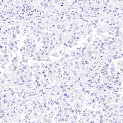 NKX3.1 Recombinant Rabbit mAb (S-2778-63)