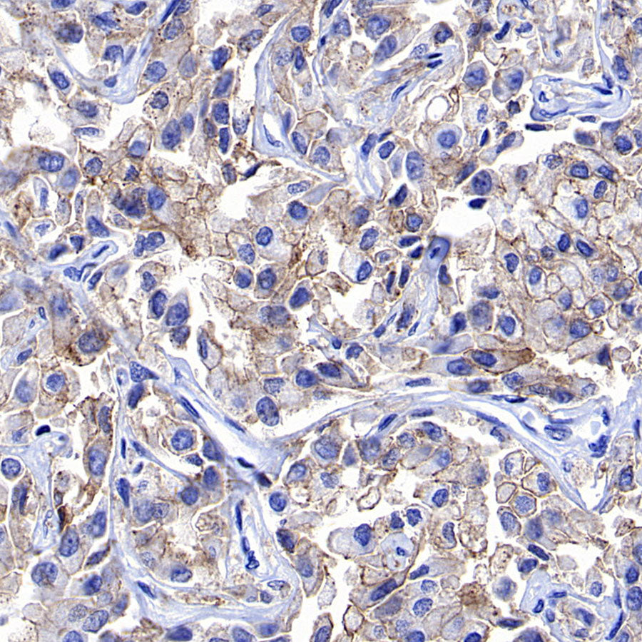 STEAP1+STEAP1B1+STEAP1B2 Recombinant Rabbit mAb (S-3226-137)