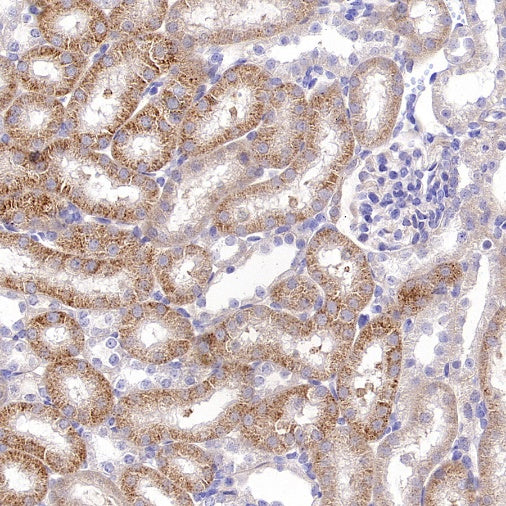 Rictor Recombinant Rabbit mAb (S-2601-26)