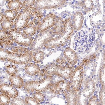 Rictor Recombinant Rabbit mAb (S-2601-26)