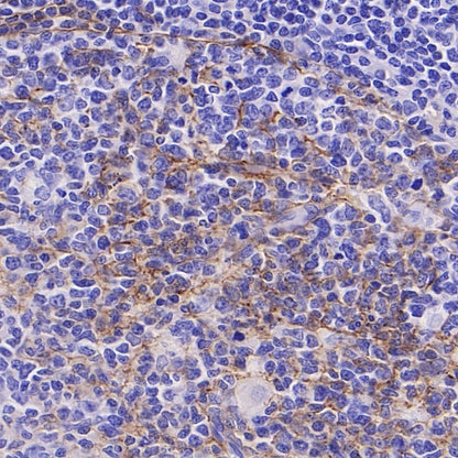 LICAM Recombinant Rabbit mAb (SDT-2594-39)