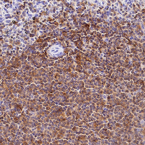 LY9/CD229 Recombinant Rabbit mAb (SDT-2393-47)