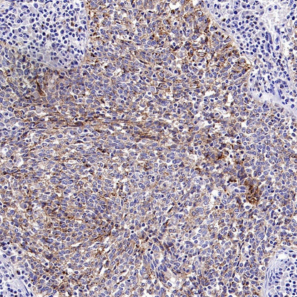 CD70 Recombinant Rabbit mAb (S-1725-277)