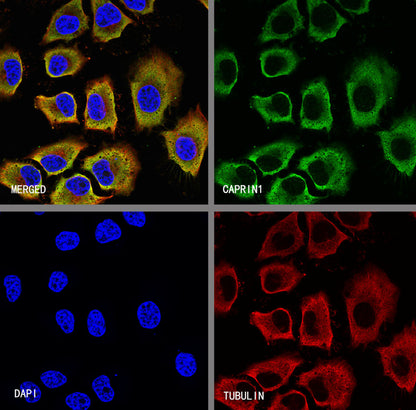 CAPRIN1 Mouse mAb