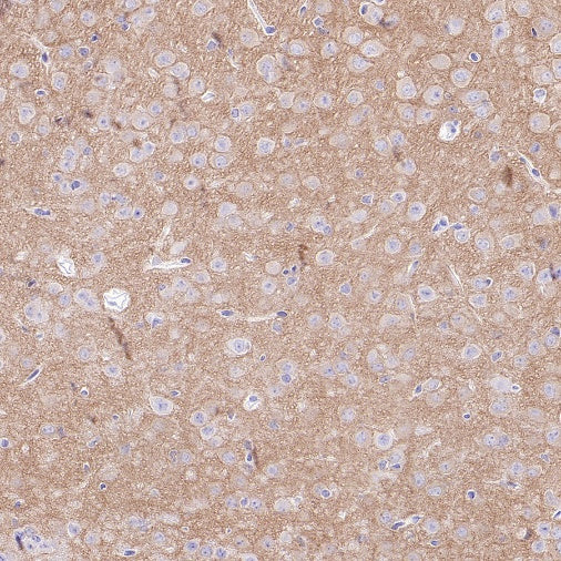 GRIA2 Rabbit Polyclonal Antibody