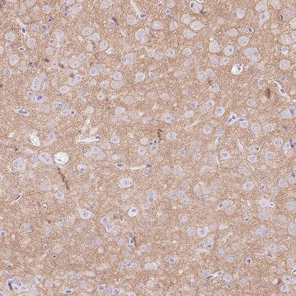 GRIA2 Rabbit Polyclonal Antibody