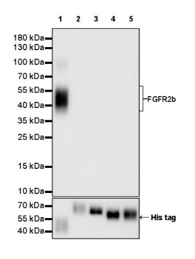 FGFR2b Recombinant Rabbit mAb (SDT-423-121)