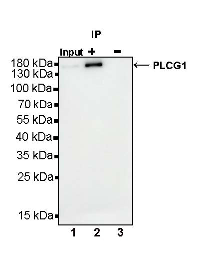 PLCG1 Recombinant Rabbit mAb (S-978-37)