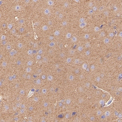 GPHN Recombinant Rabbit mAb (S-3167-63)