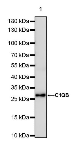 C1QB Recombinant Rabbit mAb (S-1248-314)