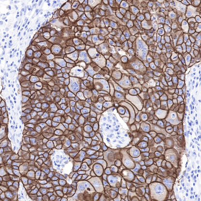 ErbB2 Recombinant Rabbit mAb (SDT-069-10)