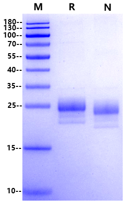 Biotinylated IL-2 His&Avi Tag Protein, Mouse