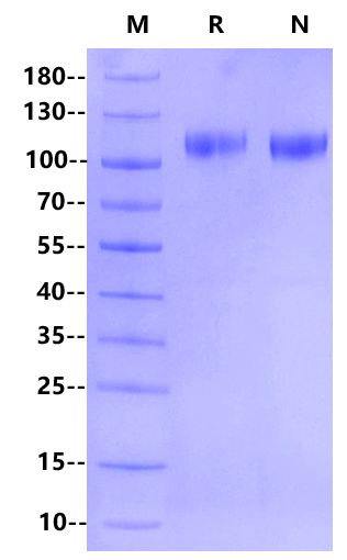 CDCP1 His Tag Protein, Human