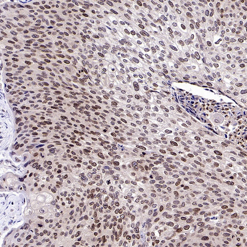 FOXM1 Recombinant Rabbit mAb (S-2529-26)