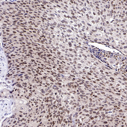 FOXM1 Recombinant Rabbit mAb (S-2529-26)