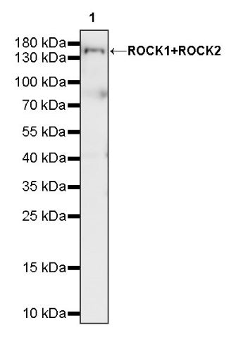 ROCK1+ROCK2 Recombinant Rabbit mAb (S-1305-26)