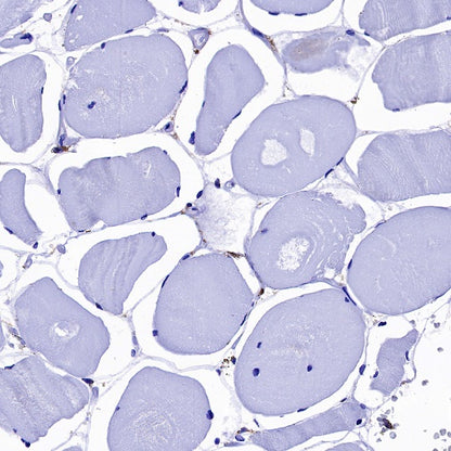 B7-H3 Recombinant Rabbit mAb (SDT-1333-8)