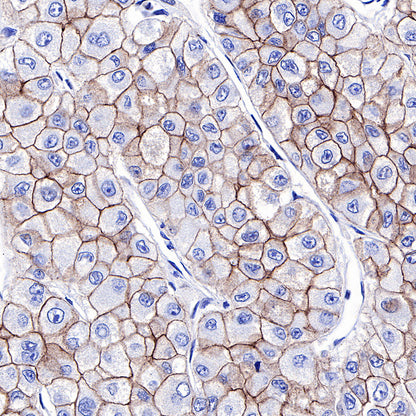 S-RMab® E-Cadherin Recombinant Rabbit mAb (SDT-R088)