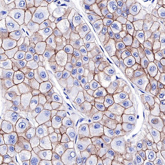 S-RMab® E-Cadherin Recombinant Rabbit mAb (SDT-R088)