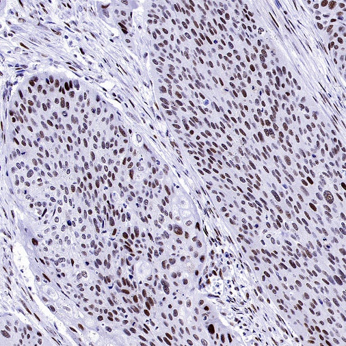 Symmetric Dimethyl Arginine (SDMA) Rabbit mAb (S-2129-14)