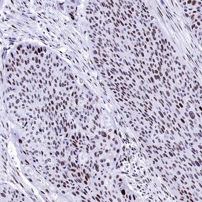 Symmetric Dimethyl Arginine (SDMA) Rabbit mAb (S-2129-14)