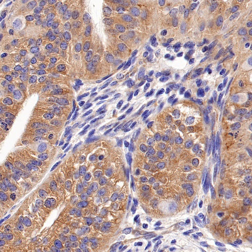 ATG9A Recombinant Rabbit mAb (S-1418-5)