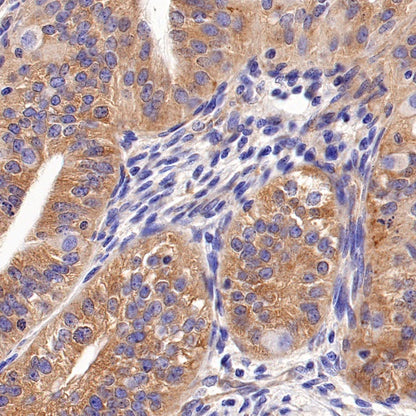 ATG9A Recombinant Rabbit mAb (S-1418-5)