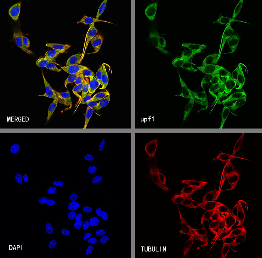 Upf1 Rabbit Polyclonal Antibody