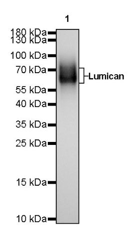 Lumican Recombinant Rabbit mAb (S-247-47)