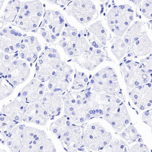 PLAP+ALPI Recombinant Rabbit mAb (SDT-167-155)