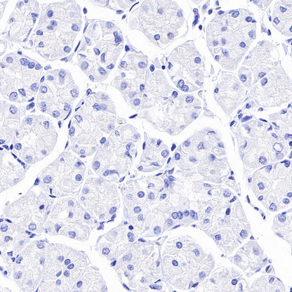 PLAP+ALPI Recombinant Rabbit mAb (SDT-167-155)