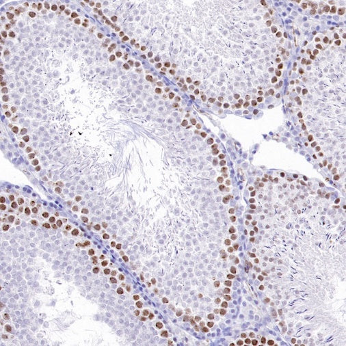 TOP2A Recombinant Rabbit mAb (S-513-107)