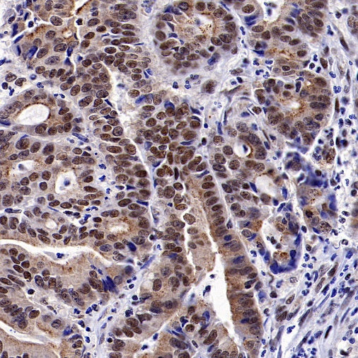 ALKBH5 Recombinant Rabbit mAb (S-2264-39)