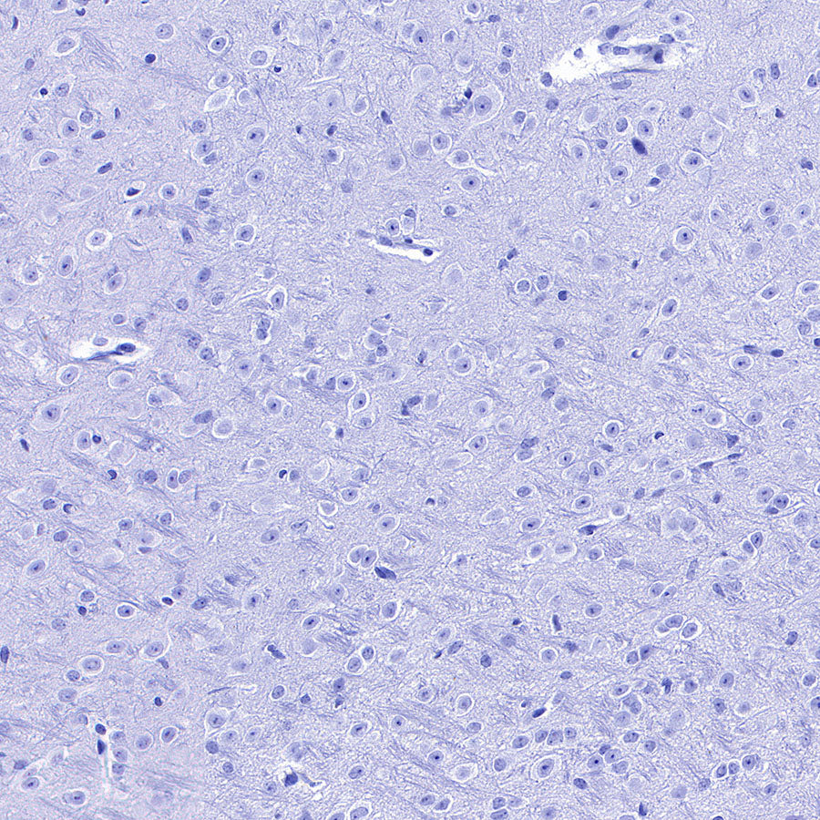 Perilipin-1 Recombinant Rabbit mAb (S-3093-31)