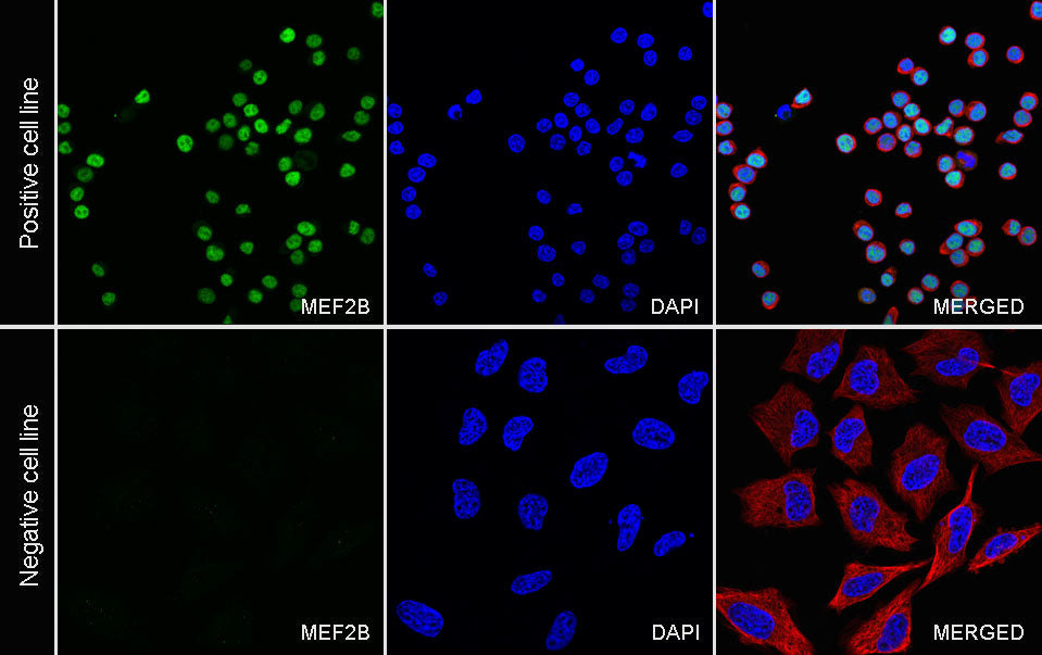 MEF2B Recombinant Rabbit mAb (S-3788-28)