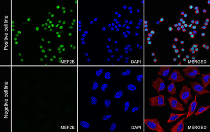 MEF2B Recombinant Rabbit mAb (S-3788-28)
