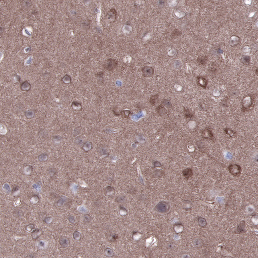 S-RMab® PTEN Recombinant Rabbit mAb (SDT-R069)