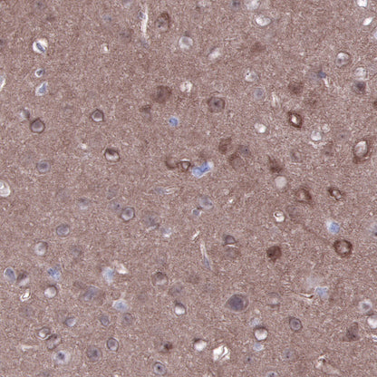 S-RMab® PTEN Recombinant Rabbit mAb (SDT-R069)