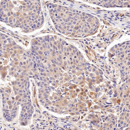 FAM129B Recombinant Rabbit mAb (S-1534-24)