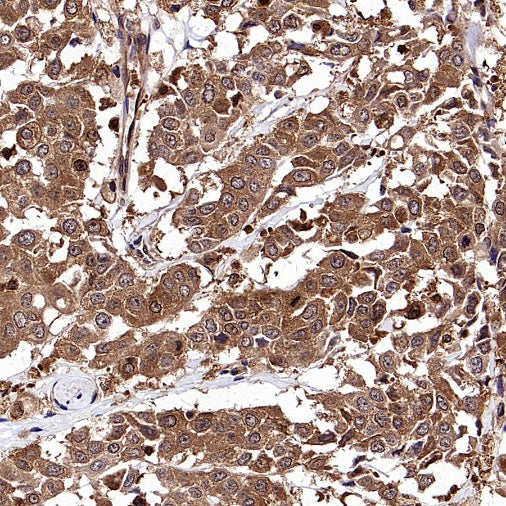 NF-κB p105/p50 Recombinant Rabbit mAb (S-3354)